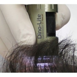 Video Tricoscop HD 5 MPX - Video Microscop Tricologie - TrichoScope HR Video Tricoscop HD 5 MPX - Video Microscop Tricologie - TrichoScope HR